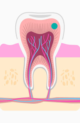 Zubovina